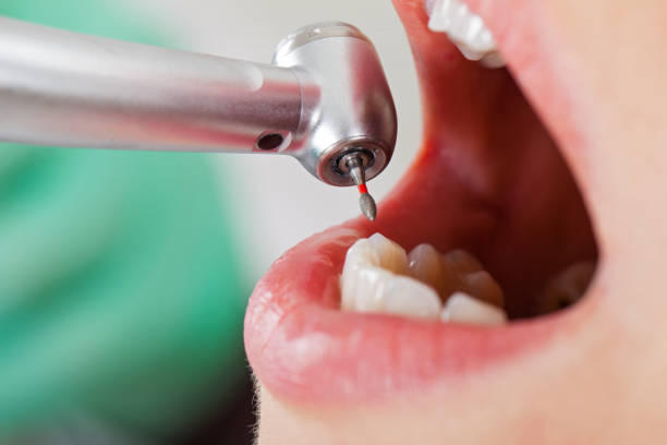 Best 24-Hour Emergency Dentist in Twain Harte, CA